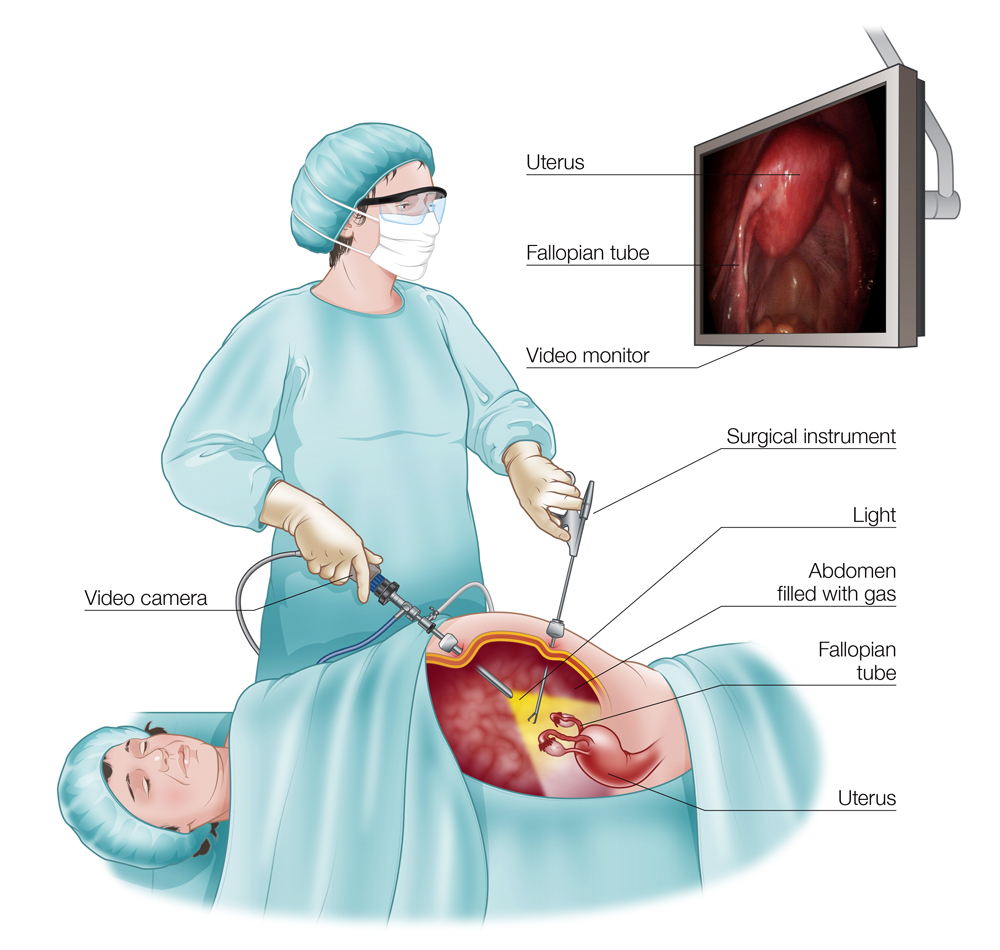 Laparoscopic surgery/minimal invasive surgery